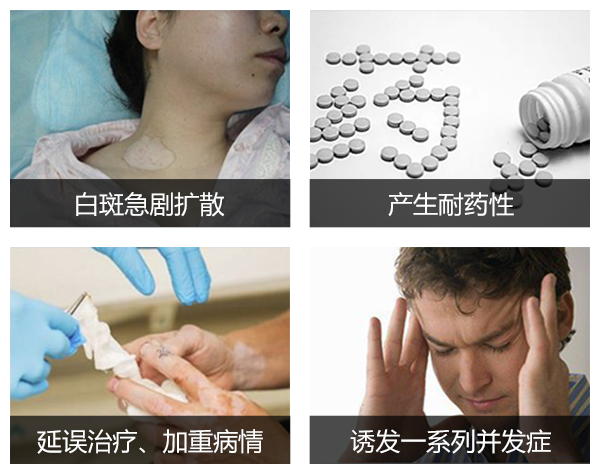 合肥华研专治白癜风