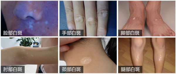 合肥华研医院好不好啊