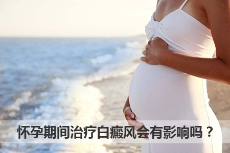 孕妇怀孕期间能不能继续治疗白癜风