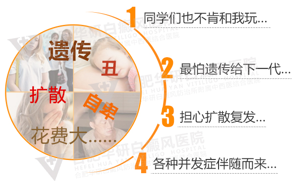 合肥华研白癜风医院的口碑好吗