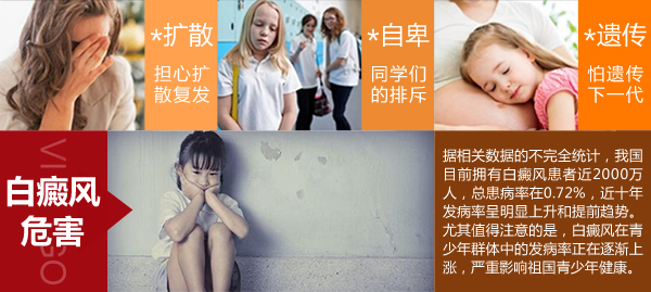 脸上长白癜风给女性带来哪些危害