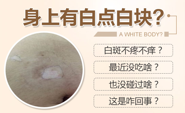 患者怎样正确认识白癜风初期的症状