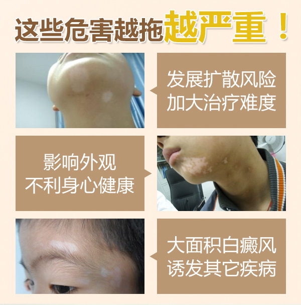 合肥华研白癜风医院的地址在哪