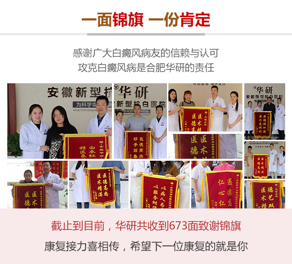 合肥华研白癜风医院怎么样