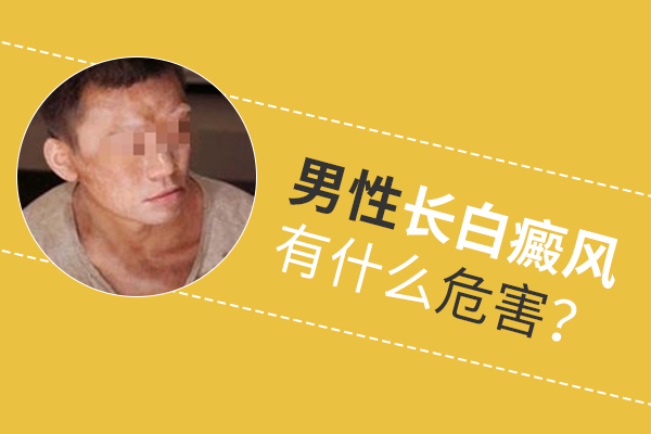 白癜风对南通男性的隐患