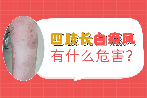 杭州专科治白斑 导致白癜风难治的原因是什么