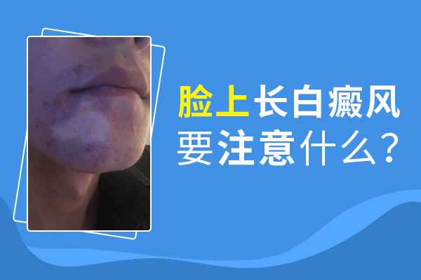 孩子脸上出现了白癜风应该怎么办?