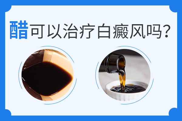 醋可以用来治疗白癜风吗?