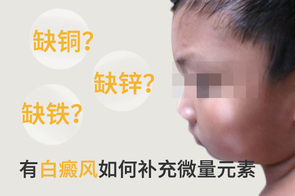 白癜风患者应该补充哪些微量元素?