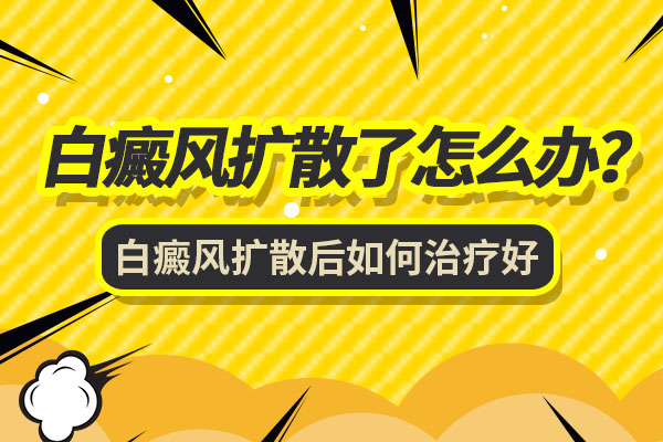 腿上的白癜风已经扩散了怎么办
