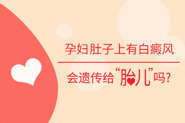 孕妇得了白癜风会遗传给孩子吗?