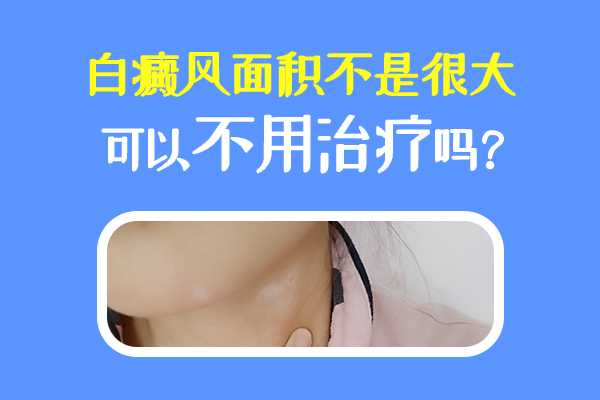 杭州白癜风哪家好 小孩得白癜风要注意哪些方面呢