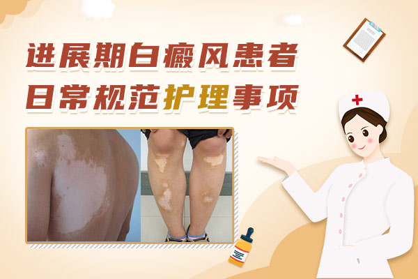 白癜风面积很大平时怎么护理