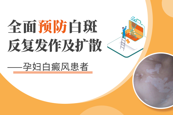 孕期患上白癜风需要注意些什么?