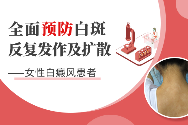 女性治疗白癜风疾病有哪些方法呢?