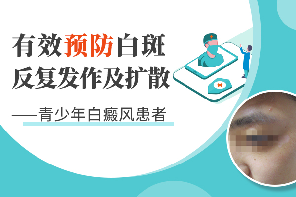 白癜风日常注意事项?